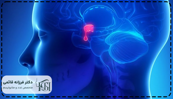 اختلالات غدد هیپوفیز چیست