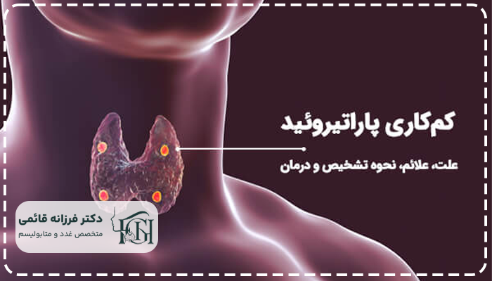 کم کاری پاراتیروئید