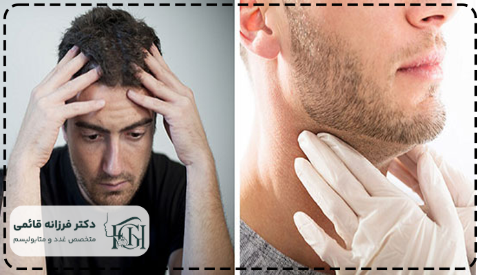 تیروئید عصبی چیست