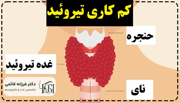علائم تیروئید کم کار