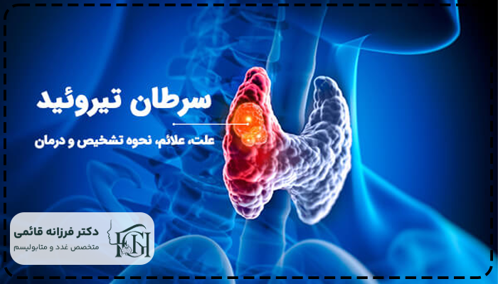 سرطان تیروئیدچیست
