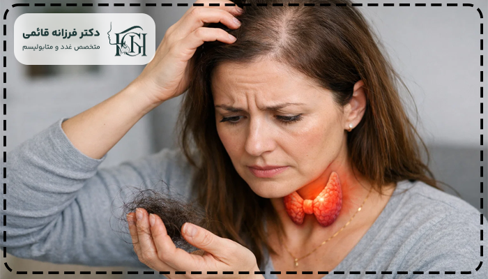 قرص کم کاری تیروئید باعث ریزش مو میشود