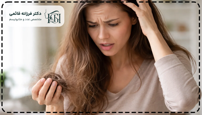 کم کاری تیروئید و ریزش مو